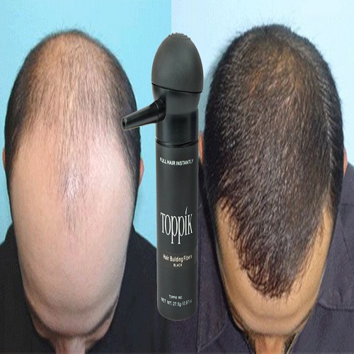 عرض مجموعة توبيك هير الامريكي الطبيعي الحل الفوري لفراغات الشعر - Image 8