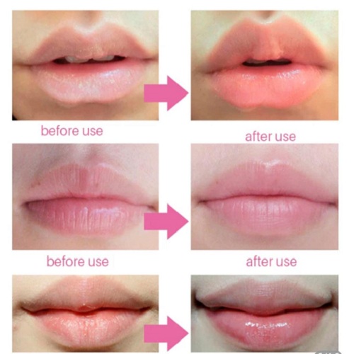 الكريم الكوري المعالج للشفايف عرض قطعتين- Laneige Lip Sleeping Mask - Image 4