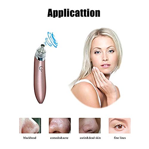 XN-8030 منظف مسام الوجه بشكل عميق ومزيل الرؤوس السوداء الكهربائي - Image 3